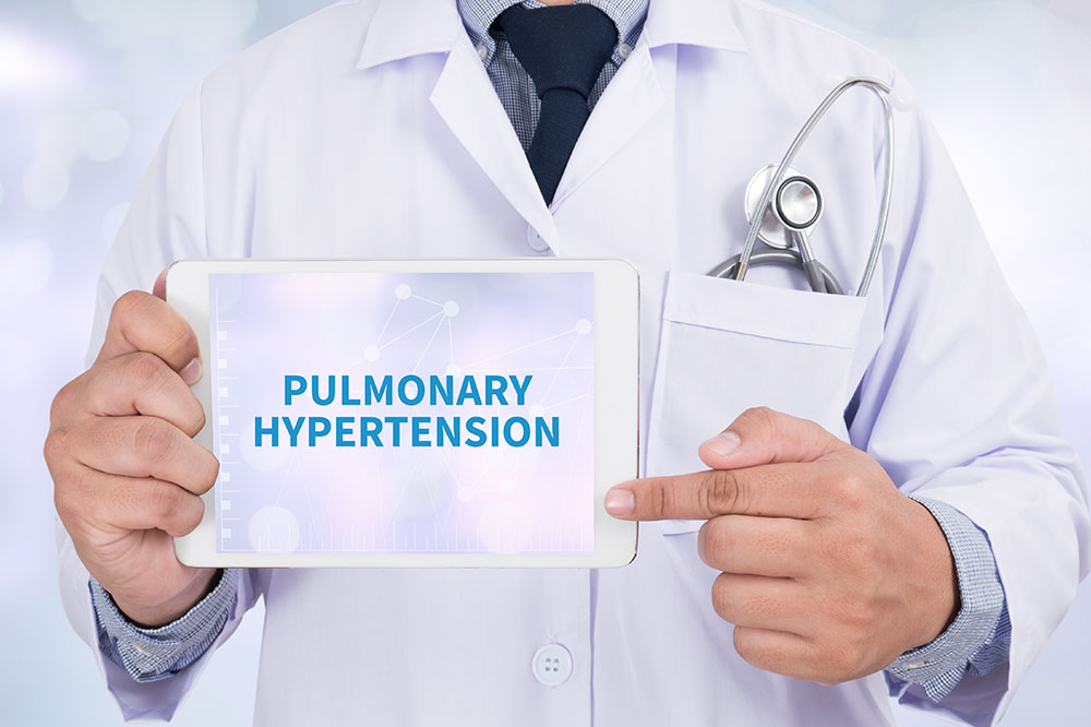 7 Crucial Things to Know about PAH