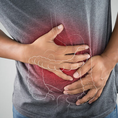 Colon Cancer in Men vs. Women